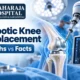 robotic_knee_replacement_featured